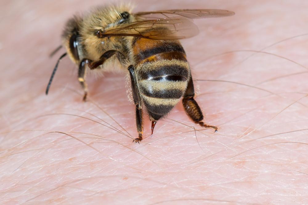 Cómo tratar una picadura de abeja en niños
